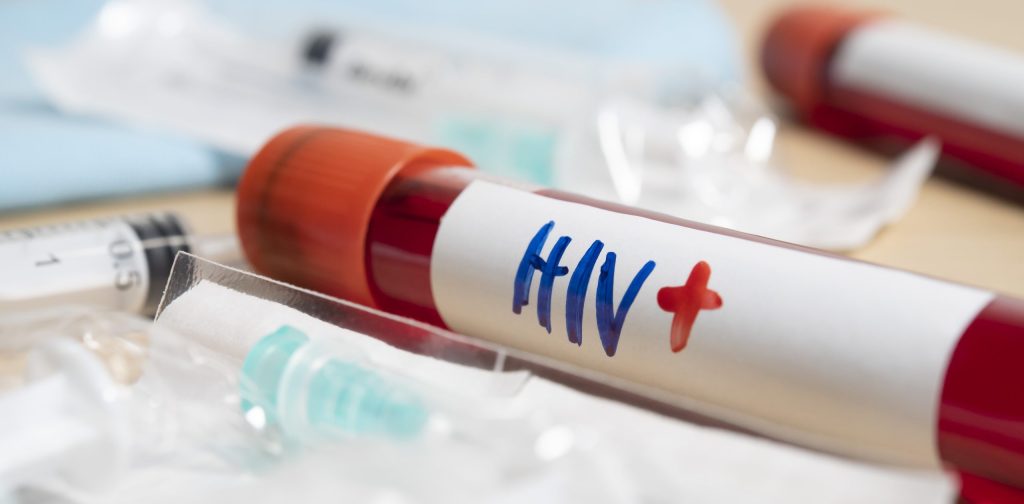 HIV Anzeichen entdeckt - HIV positiv?